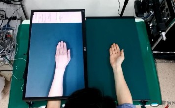 【零镜观察:AR+医疗】惊!让截肢患者摆脱痛苦的AR技术真的来了